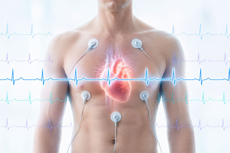 增强型心电图（ECG）数据集