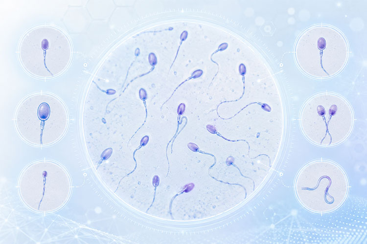 精子形态学图像数据集